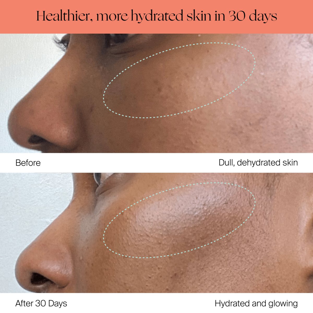 Before & after photos using a bedside humidifier